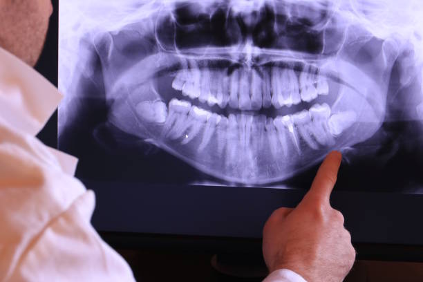Best Emergency Pediatric Dental Care in Brown City, MI